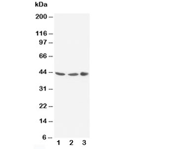 GJA1 / CX43 / Connexin 43 Antibody - Western blot testing of Connexin 43 antibody and rat samples Lane 1: heart; 2: heart; 3: brain tissue lysate. Predicted molecular weight: 43 kDa
