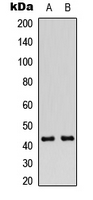 GJA1 / CX43 / Connexin 43 Antibody - Western blot analysis of Connexin 43 (pS368) expression in Jurkat (A); A549 (B) whole cell lysates.