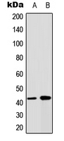 GJA1 / CX43 / Connexin 43 Antibody - Western blot analysis of Connexin 43 expression in HeLa (A); MCF7 (B) whole cell lysates.