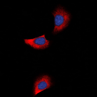 GJA1 / CX43 / Connexin 43 Antibody - Immunofluorescent analysis of Connexin 43 staining in HeLa cells. Formalin-fixed cells were permeabilized with 0.1% Triton X-100 in TBS for 5-10 minutes and blocked with 3% BSA-PBS for 30 minutes at room temperature. Cells were probed with the primary antibody in 3% BSA-PBS and incubated overnight at 4 ??C in a humidified chamber. Cells were washed with PBST and incubated with a DyLight 594-conjugated secondary antibody (red) in PBS at room temperature in the dark. DAPI was used to stain the cell nuclei (blue).