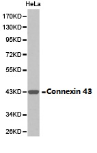GJA1 / CX43 / Connexin 43 Antibody - Western blot of extracts of HeLa cell lines, using Connexin 43 antibody.