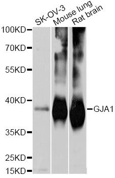 GJA1 / CX43 / Connexin 43 Antibody - Western blot analysis of extracts of various cell lines, using GJA1 antibody at 1:1000 dilution. The secondary antibody used was an HRP Goat Anti-Rabbit IgG (H+L) at 1:10000 dilution. Lysates were loaded 25ug per lane and 3% nonfat dry milk in TBST was used for blocking. An ECL Kit was used for detection and the exposure time was 10s.