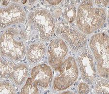 GJA1 / CX43 / Connexin 43 Antibody - 1:200 staining human kidney tissue by IHC-P. The tissue was formaldehyde fixed and a heat mediated antigen retrieval step in citrate buffer was performed. The tissue was then blocked and incubated with the antibody for 1.5 hours at 22°C. An HRP conjugated goat anti-rabbit antibody was used as the secondary.