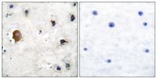 GJA1 / CX43 / Connexin 43 Antibody - Peptide - + Immunohistochemical analysis of paraffin-embedded human brain tissue using Connexin 43 antibody.