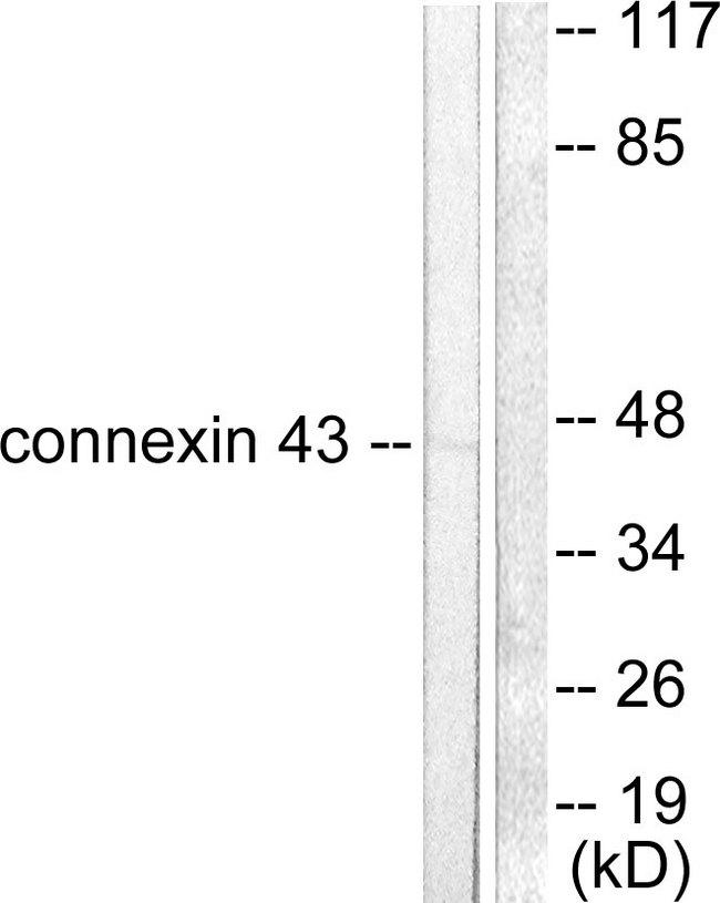 GJA1 / CX43 / Connexin 43 Antibody - Western blot analysis of extracts from A549 cells, using Connexin 43 antibody.