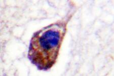 GJA1 / CX43 / Connexin 43 Antibody - IHC of Connexin 43 (K257) pAb in paraffin-embedded human brain tissue.