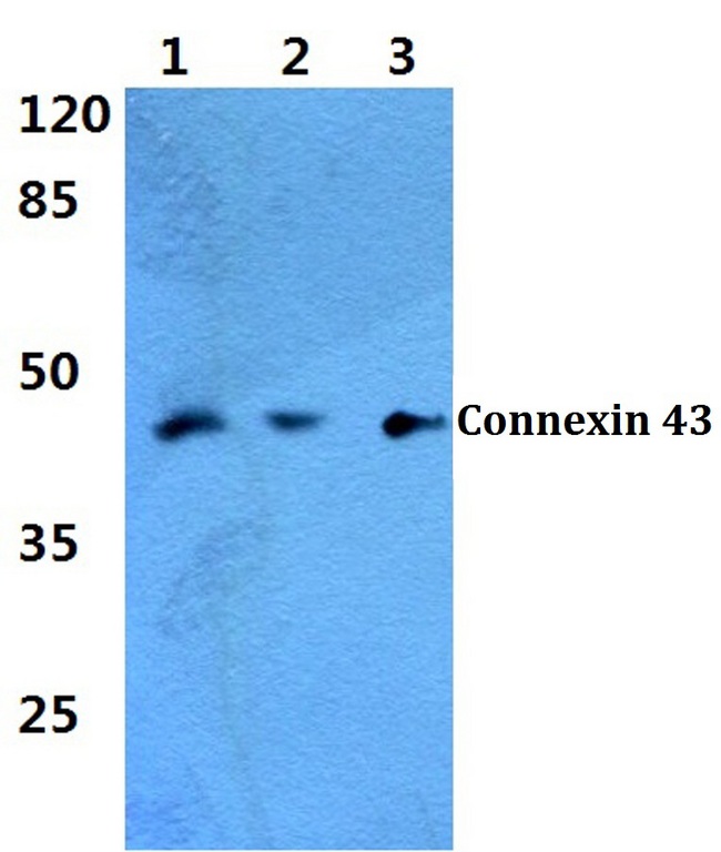 GJA1 / CX43 / Connexin 43 Antibody - Western blot analysis of Connexin 43 antibody at 1:500 dilution.  Lane 1: MCF-7 cell lysate, Lane 2: HeLa cell lysate, Lane 3: Raw264.7 cell lysate.