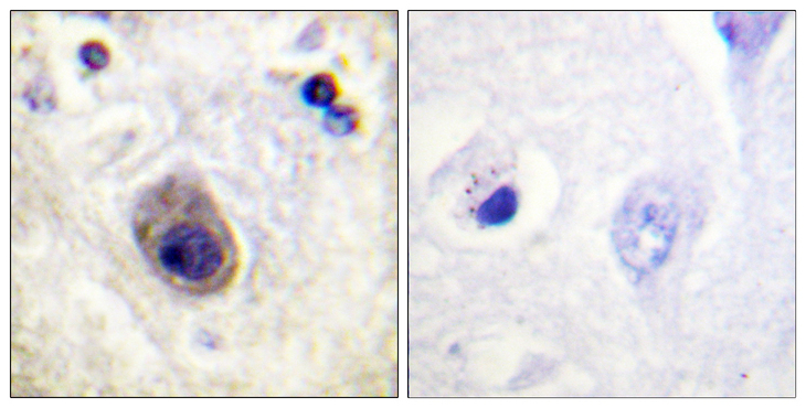 GJA1 / CX43 / Connexin 43 Antibody - Immunohistochemistry analysis of paraffin-embedded human brain, using Connexin 43 (Phospho-Ser261) Antibody. The picture on the right is blocked with the phospho peptide.