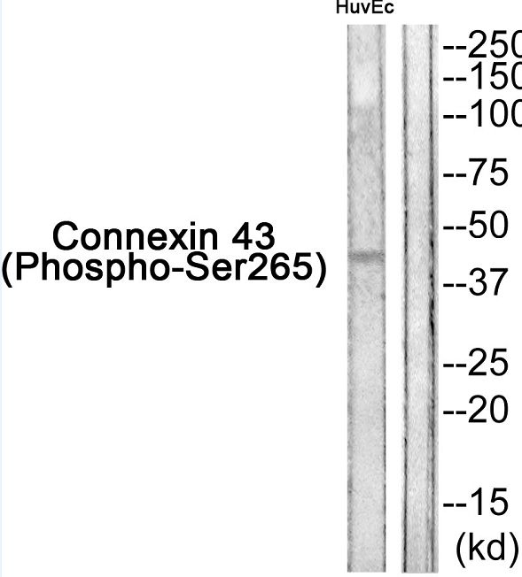 GJA1 / CX43 / Connexin 43 Antibody - Western blot of extracts from HUVEC cells, using Connexin 43 (Phospho-Ser265) Antibody.