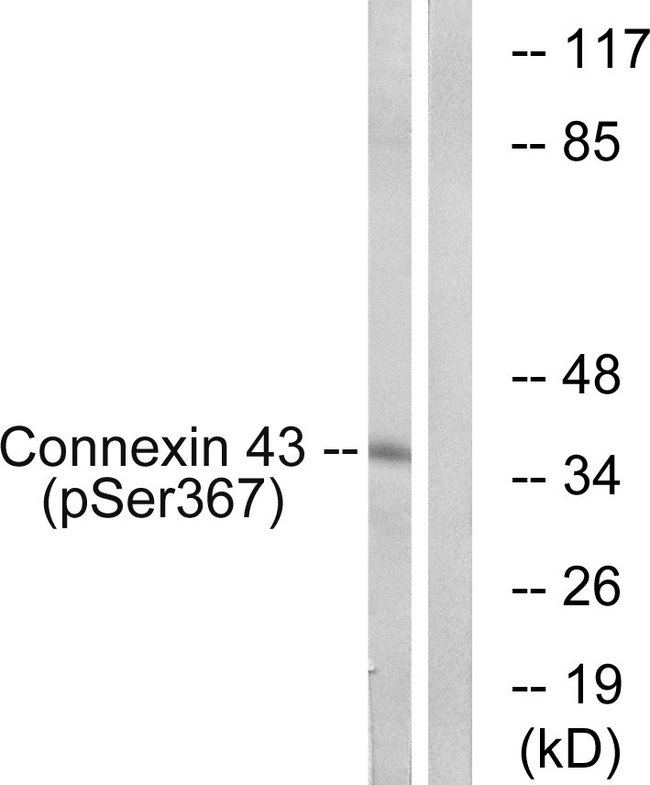 GJA1 / CX43 / Connexin 43 Antibody - Western blot analysis of lysates from K562 cells treated with PMA 200ng/ml 10', using Connexin 43 (Phospho-Ser367) Antibody. The lane on the right is blocked with the phospho peptide.