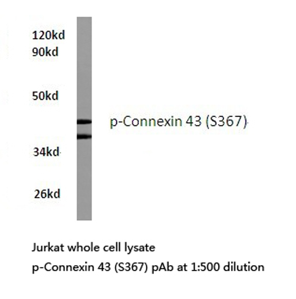 GJA1 / CX43 / Connexin 43 Antibody - Western blot of p-Connexin 43 (S367) pAb in extracts from Jurkat cells.