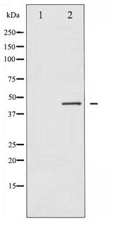 GJA1 / CX43 / Connexin 43 Antibody - Western blot of Connexin 43 phosphorylation expression in PMA treated K562 whole cell lysates,The lane on the left is treated with the antigen-specific peptide.