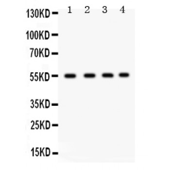 GJA3 / CX46 / Connexin 46 Antibody - GJA3 antibody Western blot. All lanes: Anti GJA3 at 0.5 ug/ml. Lane 1: Rat Cardiac Muscle Tissue Lysate at 50 ug. Lane 2: Rat Kidney Tissue Lysate at 50 ug. Lane 3: Human Placenta Tissue Lysate at 50 ug. Lane 4: NIH3T3 Whole Cell Lysate at 40 ug. Predicted band size: 47 kD. Observed band size: 55 kD.