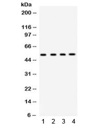 GJA3 / CX46 / Connexin 46 Antibody