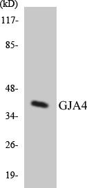 GJA4 / CX37 / Connexin 37 Antibody - Western blot analysis of the lysates from 293 cells using GJA4 antibody.