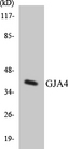 GJA4 / CX37 / Connexin 37 Antibody - Western blot analysis of the lysates from 293 cells using GJA4 antibody.