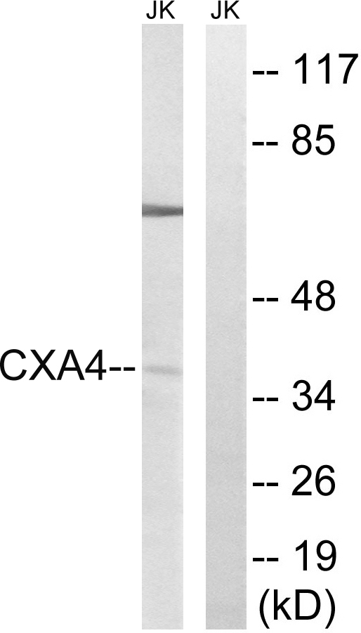 GJA4 / CX37 / Connexin 37 Antibody - Western blot analysis of lysates from Jurkat cells, using GJA4 Antibody. The lane on the right is blocked with the synthesized peptide.