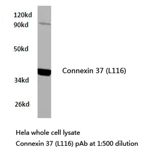 GJA4 / CX37 / Connexin 37 Antibody - Western blot of Connexin 37 (L116) pAb in extracts from HeLa cells.