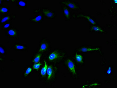 GJA4 / CX37 / Connexin 37 Antibody - Immunofluorescent analysis of Hela cells using GJA4 Antibody at dilution of 1:100 and Alexa Fluor 488-congugated AffiniPure Goat Anti-Rabbit IgG(H+L)
