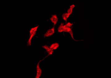 GJA4 / CX37 / Connexin 37 Antibody - Staining HeLa cells by IF/ICC. The samples were fixed with PFA and permeabilized in 0.1% Triton X-100, then blocked in 10% serum for 45 min at 25°C. The primary antibody was diluted at 1:200 and incubated with the sample for 1 hour at 37°C. An Alexa Fluor 594 conjugated goat anti-rabbit IgG (H+L) Ab, diluted at 1/600, was used as the secondary antibody.