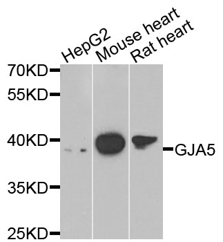 GJA5 / CX40 / Connexin 40 Antibody - Western blot analysis of extracts of various cells.