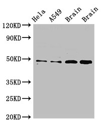 GJA8 / CX50 / Connexin 50 Antibody - Positive WB detected in:Hela whole cell lysate,A549 whole cell lysate,Rat brain tissue,Mouse brain tissue;All lanes:GJA8 antibody at 2.5?g/ml;Secondary;Goat polyclonal to rabbit IgG at 1/50000 dilution;Predicted band size: 49 KDa;Observed band size: 49 KDa;