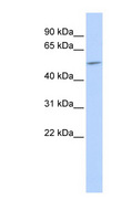 GJA9 / CX59 / Connexin 59 Antibody - GJA9 antibody Western blot of Fetal Brain lysate. This image was taken for the unconjugated form of this product. Other forms have not been tested.
