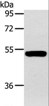 GJA9 / CX59 / Connexin 59 Antibody - Western blot analysis of Human fetal muscle tissue, using GJA9 Polyclonal Antibody at dilution of 1:400.