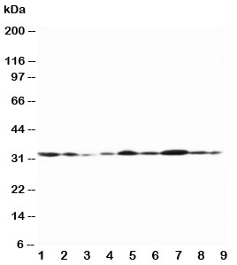 GJB1 / CX32 / Connexin 32 Antibody - Western blot testing of Connexin 32 antibody and Lane 1: rat heart; 2: rat heart; 3: rat skeletal muscle; 4: rat brain; 5: MCF-7; 6: HeLa; 7: SMMC-7721; 8: Jurkat; 9: COLO320