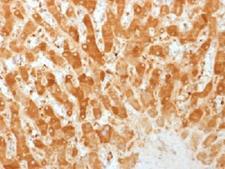 GJB1 / CX32 / Connexin 32 Antibody - IHC testing of FFPE human liver with Connexin 32 antibody (clone GJB1/1753). Required HIER: boil tissue sections in 10mM citrate buffer, pH 6, for 10-20 min.
