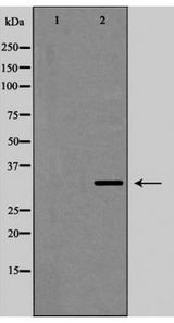 GJB1 / CX32 / Connexin 32 Antibody - Western blot of Connexin 32 expression in LOVO cells,