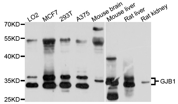GJB1 / CX32 / Connexin 32 Antibody - Western blot analysis of extracts of various cell lines, using GJB1 antibody at 1:1000 dilution. The secondary antibody used was an HRP Goat Anti-Rabbit IgG (H+L) at 1:10000 dilution. Lysates were loaded 25ug per lane and 3% nonfat dry milk in TBST was used for blocking. An ECL Kit was used for detection and the exposure time was 30s.