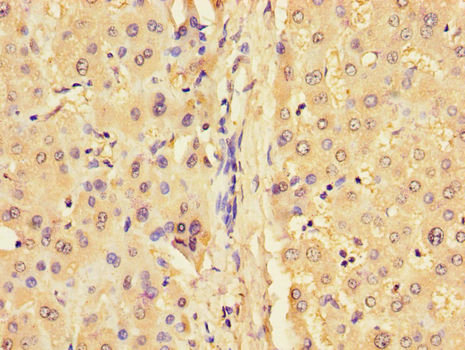 GJB1 / CX32 / Connexin 32 Antibody - Immunohistochemistry of paraffin-embedded human liver tissue using GJB1 Antibody at dilution of 1:100