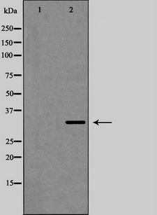 GJB1 / CX32 / Connexin 32 Antibody - Western blot analysis of Connexin 32 expression in LOVO cells,. The lane on the left is treated with the antigen-specific peptide.