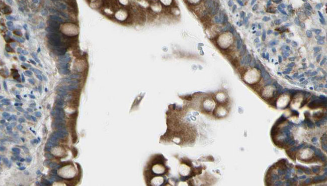 GJB1 / CX32 / Connexin 32 Antibody - 1:100 staining mouse intestine tissue by IHC-P. The sample was formaldehyde fixed and a heat mediated antigen retrieval step in citrate buffer was performed. The sample was then blocked and incubated with the antibody for 1.5 hours at 22°C. An HRP conjugated goat anti-rabbit antibody was used as the secondary.