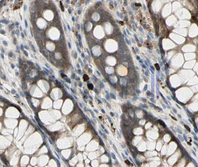 GJB1 / CX32 / Connexin 32 Antibody - 1/100 staining human colon  tissue by IHC-P. The sample was formaldehyde fixed and a heat mediated antigen retrieval step in citrate buffer was performed. The sample was then blocked and incubated with the antibody for 1.5 hours at 22°C. An HRP conjugated goat anti-rabbit antibody was used as the secondary antibody.