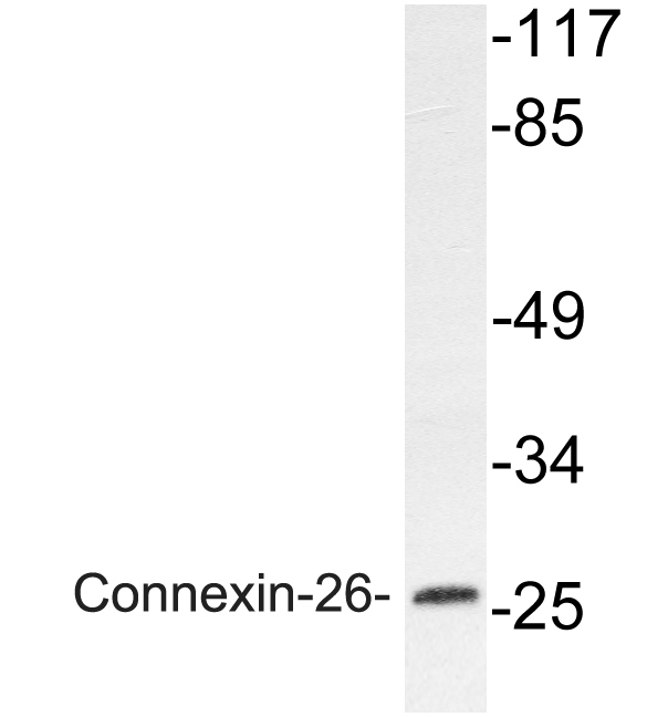 GJB2 / CX26 / Connexin 26 Antibody - Western blot analysis of lysate from Jurkat cells, using Connexin-26 antibody.