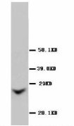 GJB2 / CX26 / Connexin 26 Antibody -  This image was taken for the unconjugated form of this product. Other forms have not been tested.
