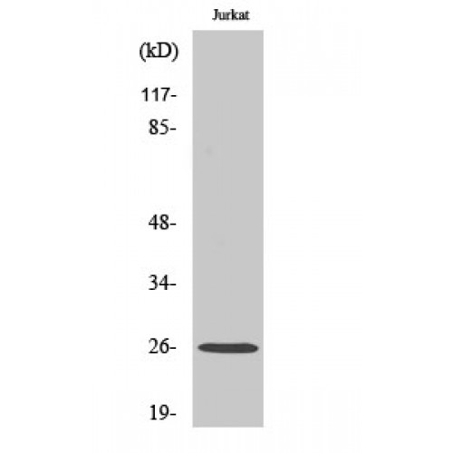 GJB2 / CX26 / Connexin 26 Antibody - Western blot of Connexin-26 antibody