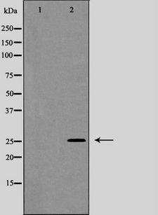 GJB2 / CX26 / Connexin 26 Antibody - Western blot analysis of Connexin 26 expression in Jurkat cells. The lane on the left is treated with the antigen-specific peptide.