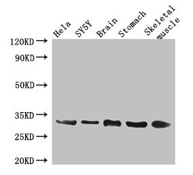 GJB3 / CX31 / Connexin 31 Antibody - Western Blot Positive WB detected in: Hela whole cell lysate, SH-SY5Y whole cell lysate, Mouse brain tissue, Mouse stomach tissue, Mouse skeletal muscle tissue All lanes: GJB3 antibody at 3µg/ml Secondary Goat polyclonal to rabbit IgG at 1/50000 dilution Predicted band size: 31 kDa Observed band size: 31 kDa