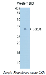 GJB3 / CX31 / Connexin 31 Antibody - Western blot of recombinant GJB3 / CX31 / Connexin 31.  This image was taken for the unconjugated form of this product. Other forms have not been tested.