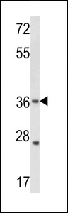 GJB3 / CX31 / Connexin 31 Antibody - Western blot of hGJB3-C241 in WiDr cell line lysates (35 ug/lane). GJB3 (arrow) was detected using the purified antibody.(2 ug/ml)