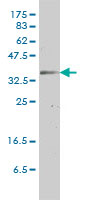 GJB3 / CX31 / Connexin 31 Antibody - GJB3 monoclonal antibody (M01), clone 3B4-1B3 Western Blot analysis of GJB3 expression in HeLa.