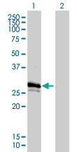 GJB3 / CX31 / Connexin 31 Antibody - Western Blot analysis of GJB3 expression in transfected 293T cell line by GJB3 monoclonal antibody (M01), clone 3B4-1B3.Lane 1: GJB3 transfected lysate(31 KDa).Lane 2: Non-transfected lysate.
