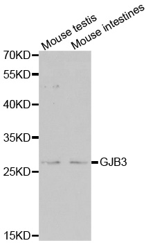 GJB3 / CX31 / Connexin 31 Antibody - Western blot analysis of extracts of Mouse brain tissue lysate, using GJB3 antibody.