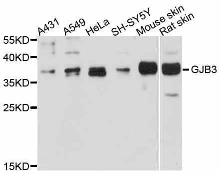 GJB3 / CX31 / Connexin 31 Antibody - Western blot analysis of extracts of various cell lines.