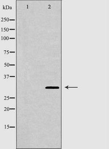 GJB3 / CX31 / Connexin 31 Antibody - Western blot analysis of extracts of mouse brain tissue lysate using GJB3 antibody. The lane on the left is treated with the antigen-specific peptide.