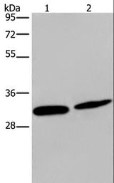 GJB4 / CX30.3 / Connexin 30.3 Antibody - Western blot analysis of Mouse skin tissue and HeLa cell, using GJB4 Polyclonal Antibody at dilution of 1:200.