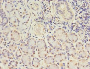 GJB5 / CX30.1 / Connexin 31.1 Antibody - Immunohistochemistry of paraffin-embedded human pancreas tissue using antibody at 1:100 dilution.  This image was taken for the unconjugated form of this product. Other forms have not been tested.